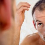 Hombre frente al espejo sufre caída del cabello