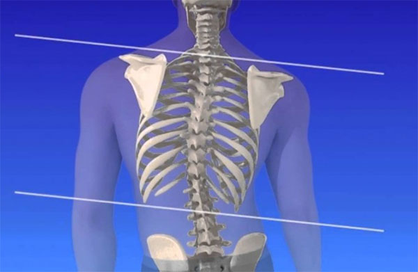 escoliosis flores bach salud
